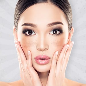 シミ・肝斑トーニング【画像】