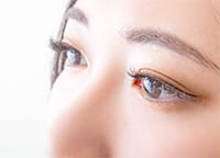 二重まぶた（二重埋没法、二重整形）