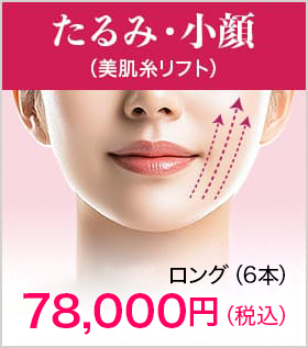 たるみ・小顔(美肌糸リフト)【画像】