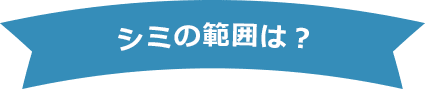 シミの範囲は?【画像】