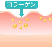 コラーゲン【画像】