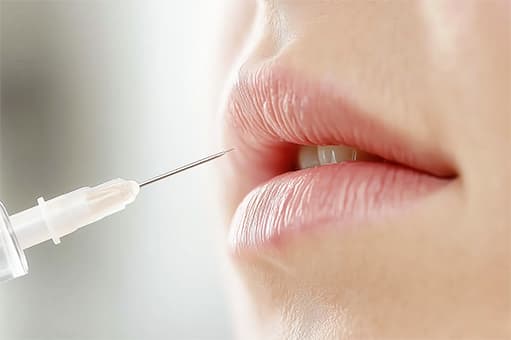 ヒアルロン酸を注入【画像】