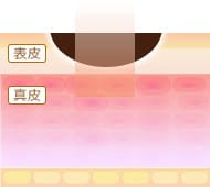 炭酸ガスレーザー(Co2レーザー)のメカニズム1【画像】