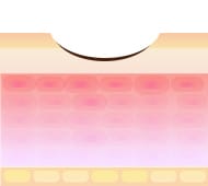 炭酸ガスレーザー(Co2レーザー)のメカニズム2【画像】