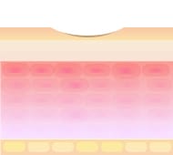 炭酸ガスレーザー(Co2レーザー)のメカニズム3【画像】