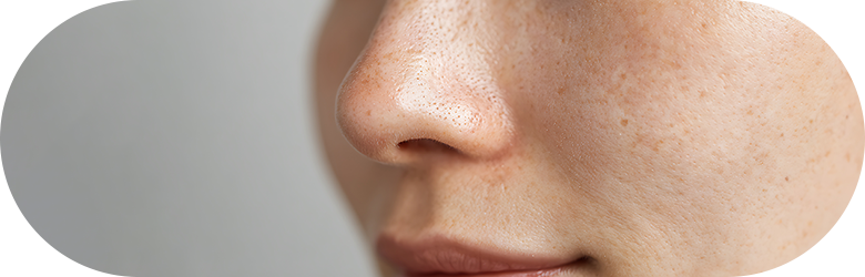 フォトシルクプラス（フォトシルク）の効果について