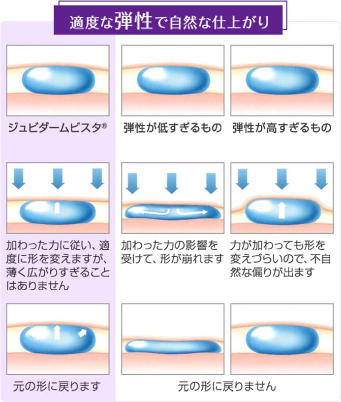 適度な弾性で自然な仕上がり【画像】